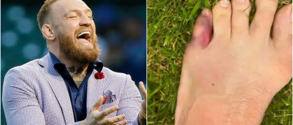 Conor McGregor