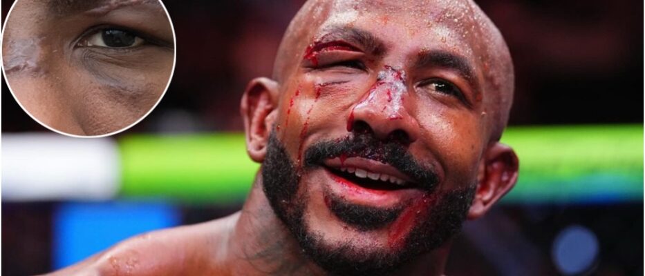 Khalil Rountree Jr. Shows Off Scars from UFC 307 Battle with Alex Pereira